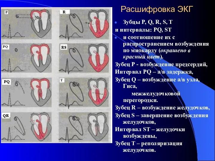 Расшифровка ЭКГ Зубцы P, Q, R, S, T и интервалы: PQ,