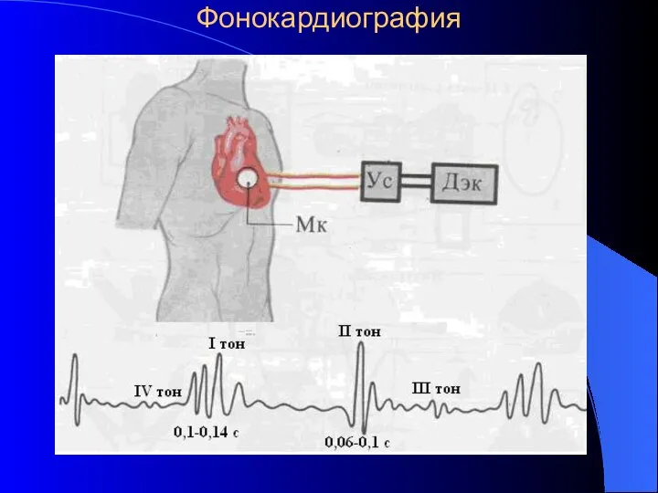 Фонокардиография