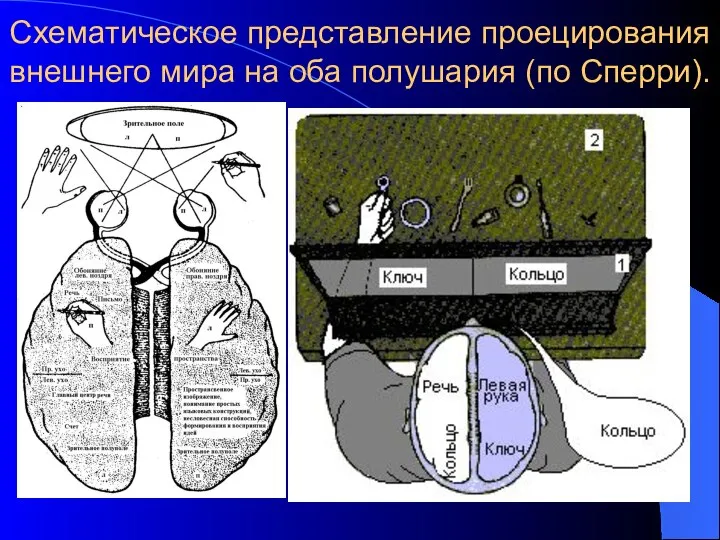 Схематическое представление проецирования внешнего мира на оба полушария (по Сперри).