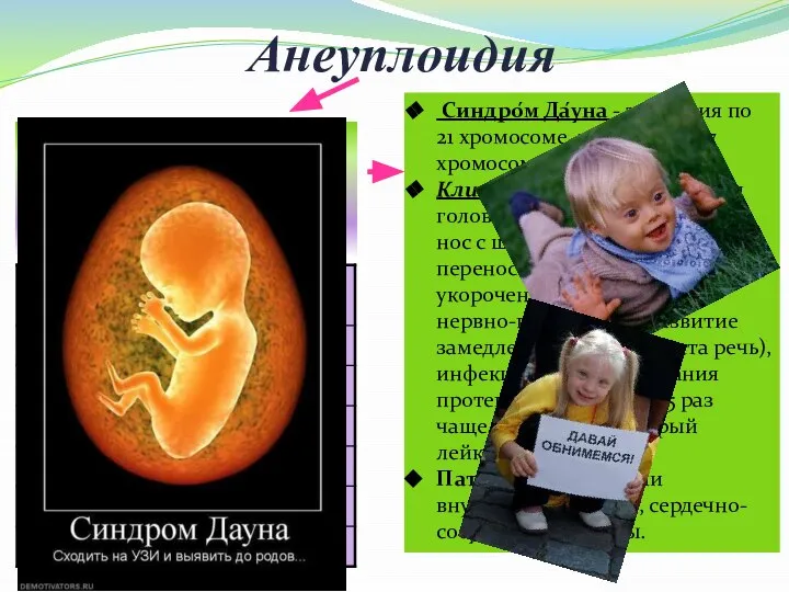 Анеуплоидия 2) Трисомия – наличие трёх гомологичных хромосом вместо пары (2n