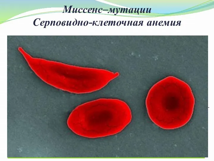 Миссенс–мутации Серповидно-клеточная анемия Замена всего лишь одного нуклеотида и одной аминокислоты