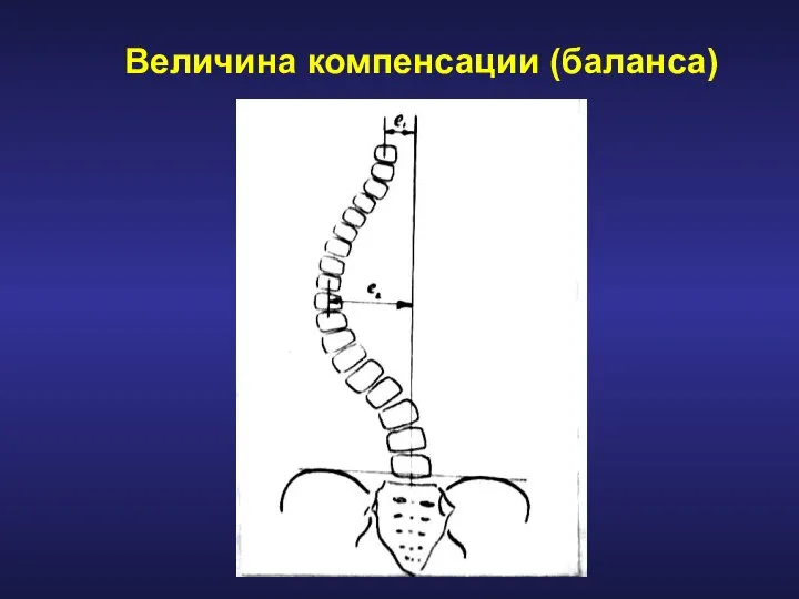 Величина компенсации (баланса)