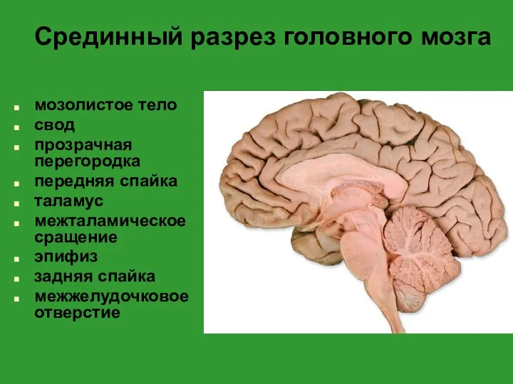 Срединный разрез головного мозга мозолистое тело свод прозрачная перегородка передняя спайка