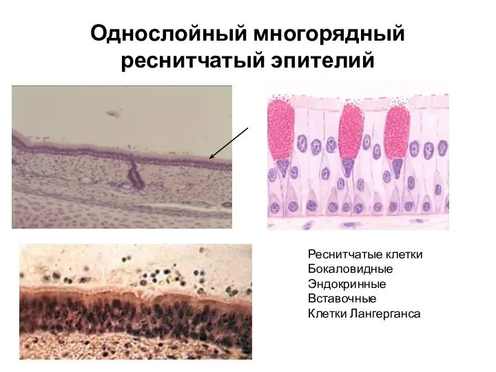 Однослойный многорядный реснитчатый эпителий Реснитчатые клетки Бокаловидные Эндокринные Вставочные Клетки Лангерганса