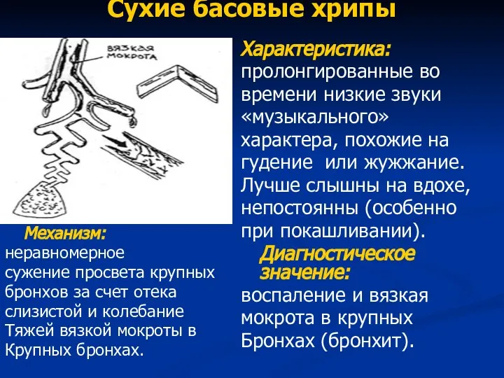 Сухие басовые хрипы Механизм: неравномерное сужение просвета крупных бронхов за счет