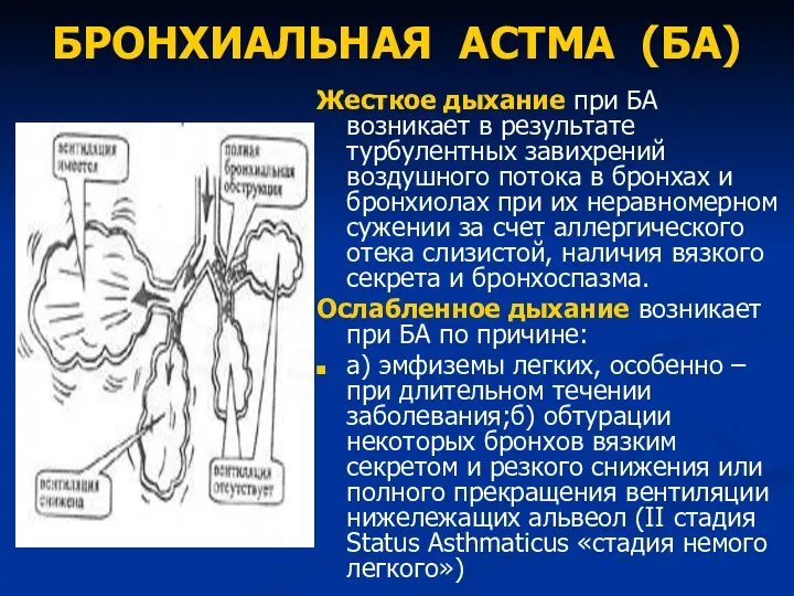 БРОНХИАЛЬНАЯ АСТМА (БА) Жесткое дыхание при БА возникает в результате турбулентных