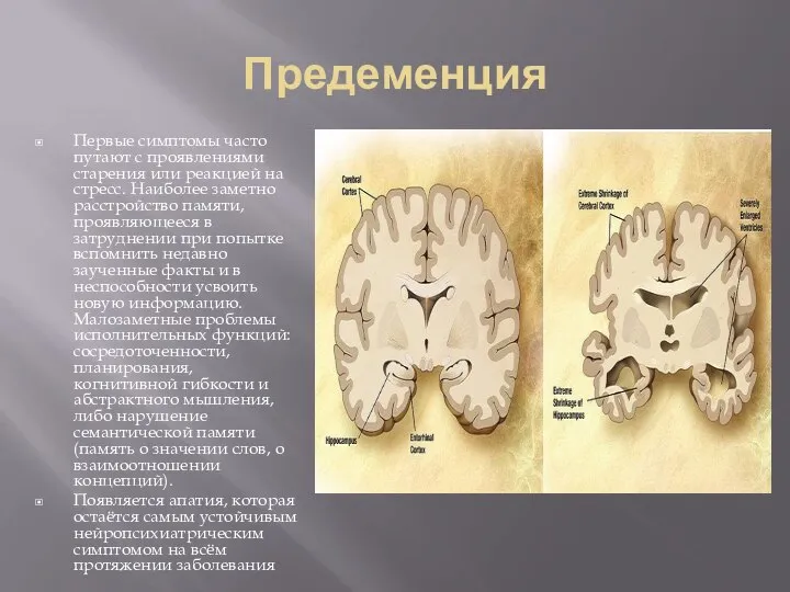 Предеменция Первые симптомы часто путают с проявлениями старения или реакцией на