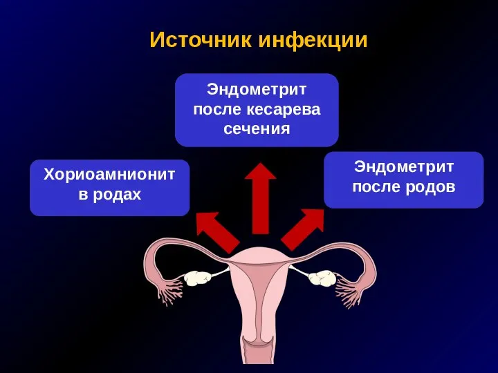 Источник инфекции Хориоамнионит в родах Эндометрит после кесарева сечения Эндометрит после родов