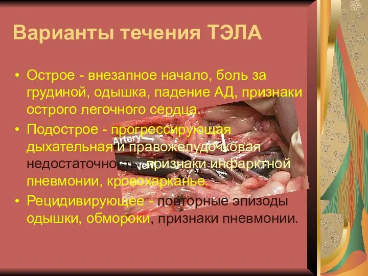 Варианты течения ТЭЛА Острое - внезапное начало, боль за грудиной, одышка,