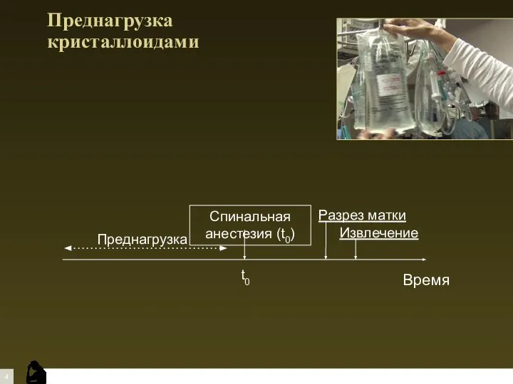 Преднагрузка кристаллоидами