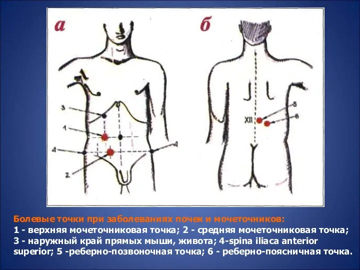 Болевые точки при заболеваниях почек и мочеточников: 1 - верхняя мочеточниковая