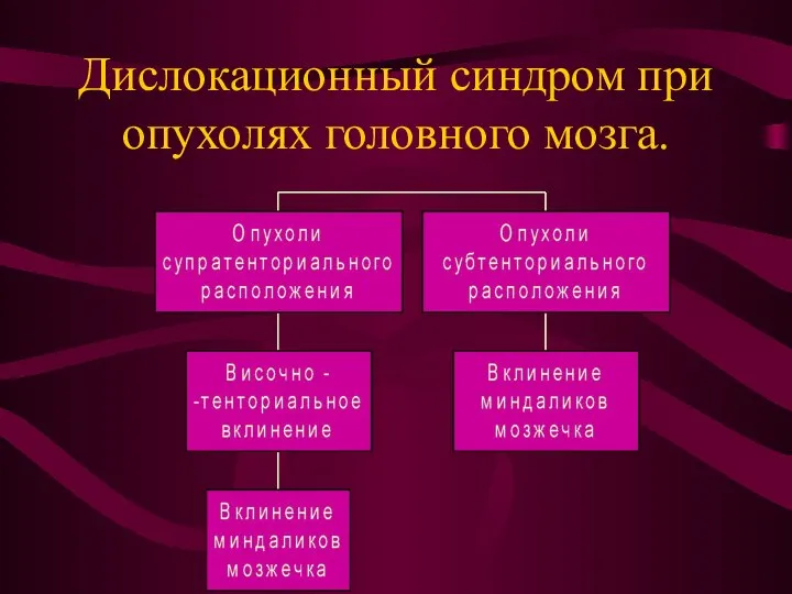 Дислокационный синдром при опухолях головного мозга.