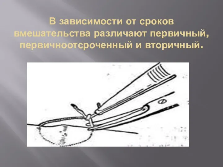 В зависимости от сроков вмешательства различают первичный, первичноотсроченный и вторичный.