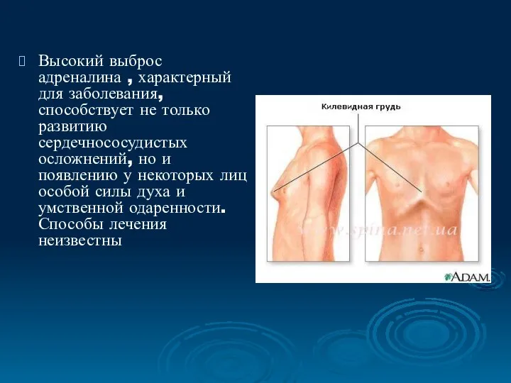 Высокий выброс адреналина , характерный для заболевания, способствует не только развитию