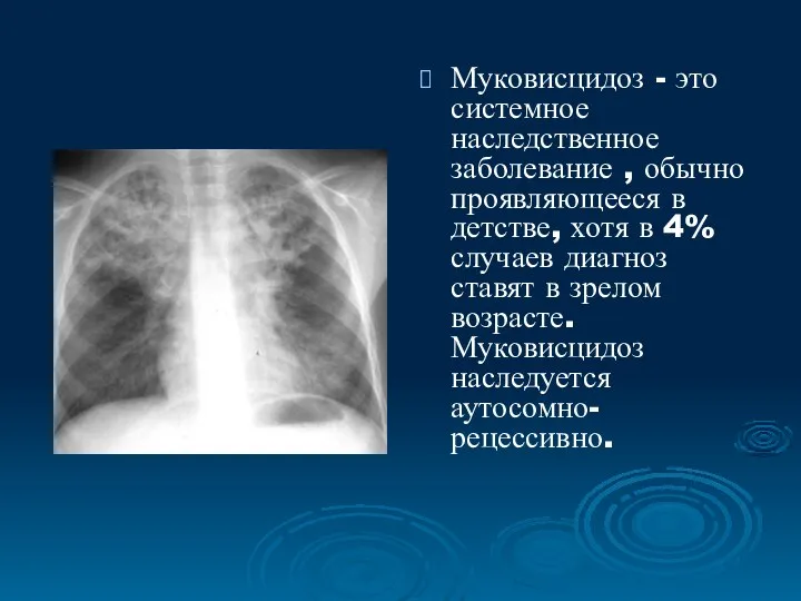 Муковисцидоз - это системное наследственное заболевание , обычно проявляющееся в детстве,