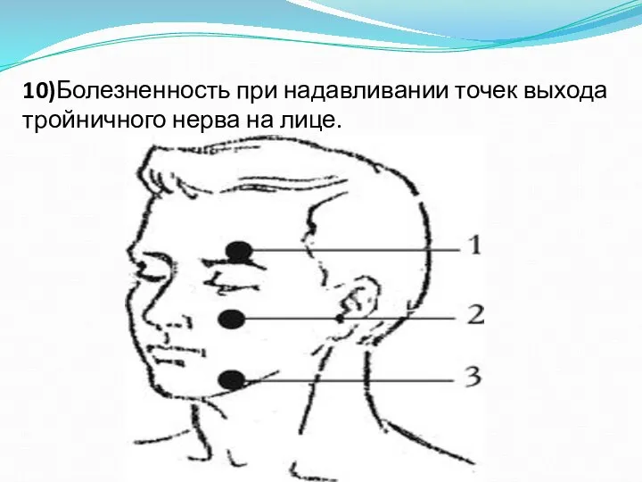 10)Болезненность при надавливании точек выхода тройничного нерва на лице.