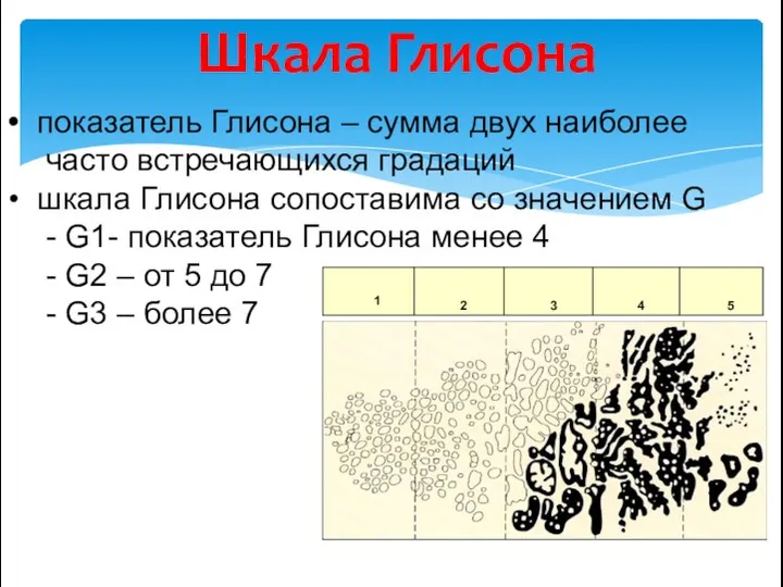 Шкала Глисона показатель Глисона – сумма двух наиболее часто встречающихся градаций