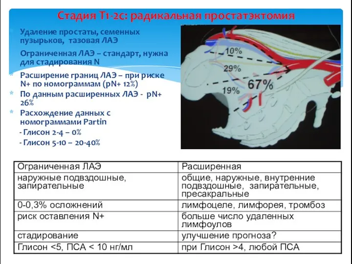 Стадия Т1-2с: радикальная простатэктомия Удаление простаты, семенных пузырьков, тазовая ЛАЭ Ограниченная