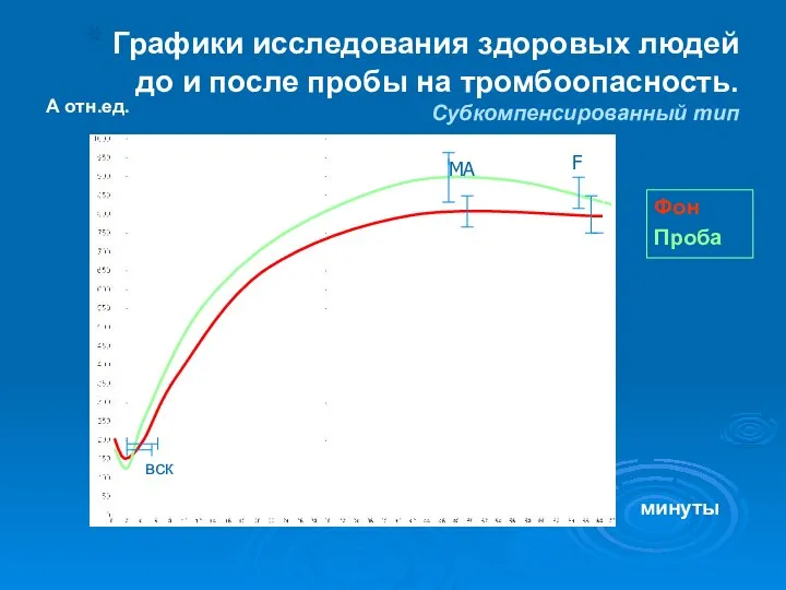 Графики исследования здоровых людей до и после пробы на тромбоопасность. Субкомпенсированный