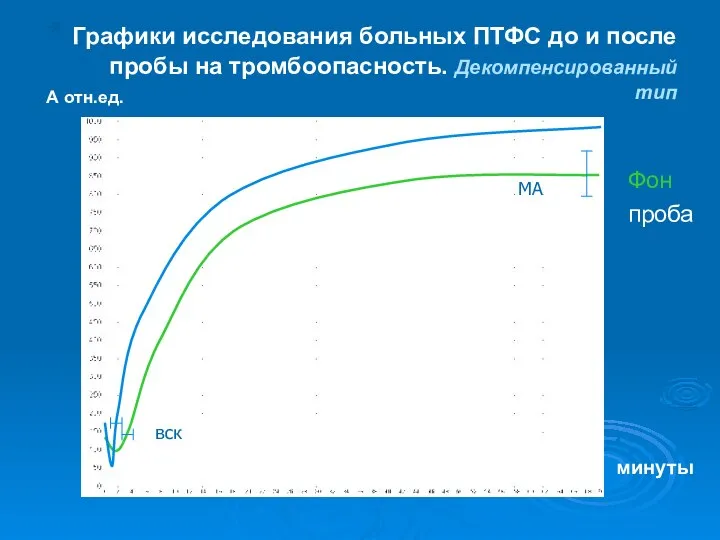 Графики исследования больных ПТФС до и после пробы на тромбоопасность. Декомпенсированный