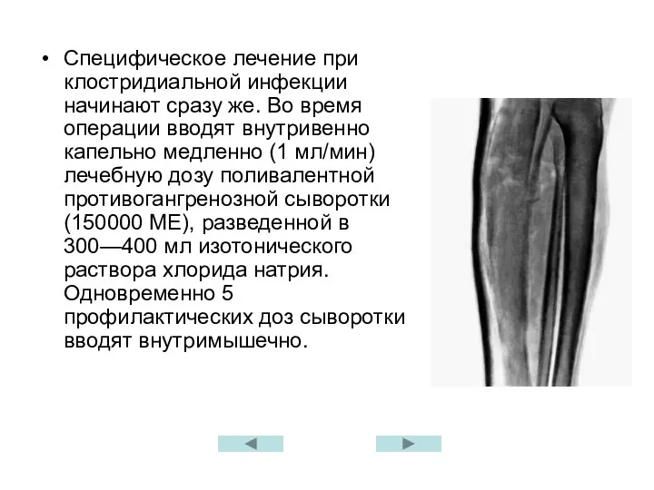 Специфическое лечение при клостридиальной инфекции начинают сразу же. Во время операции