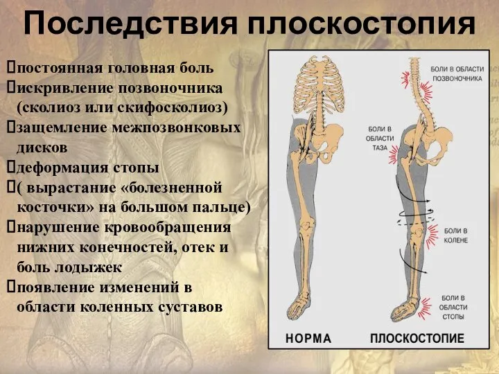 постоянная головная боль искривление позвоночника(сколиоз или скифосколиоз) защемление межпозвонковых дисков деформация