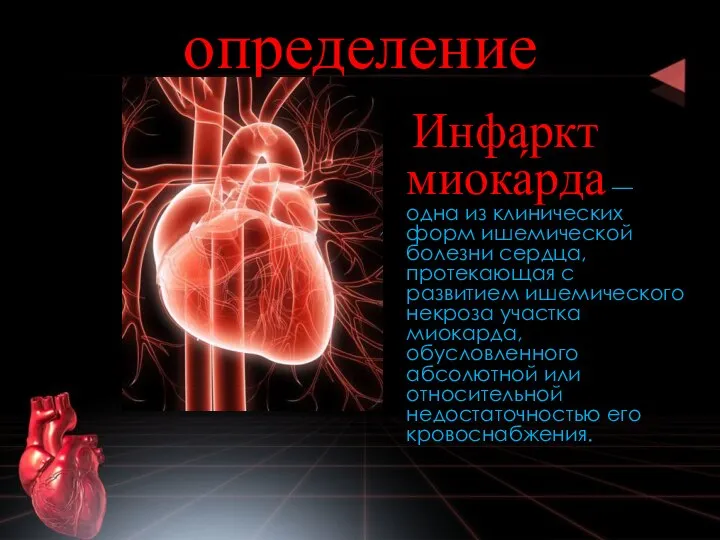 определение Инфаркт миока́рда — одна из клинических форм ишемической болезни сердца,