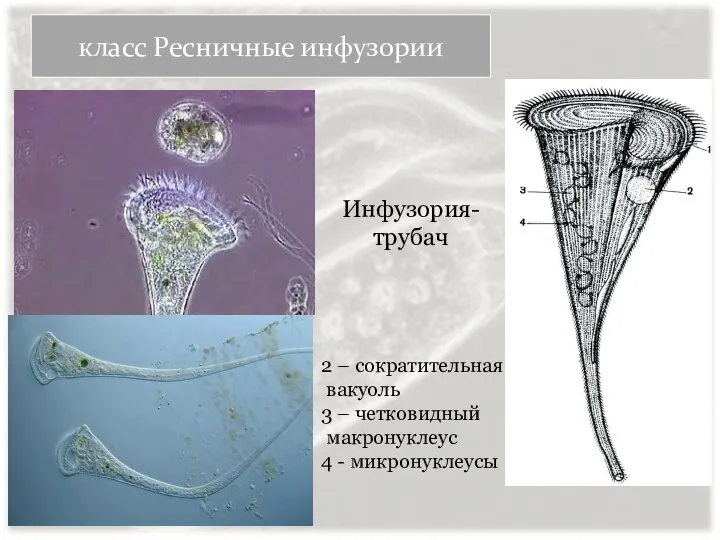 класс Ресничные инфузории Инфузория- трубач 2 – сократительная вакуоль 3 – четковидный макронуклеус 4 - микронуклеусы