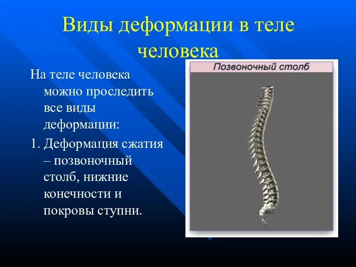 Виды деформации в теле человека На теле человека можно проследить все