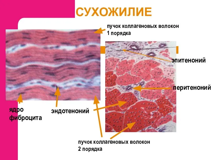 СУХОЖИЛИЕ эндотеноний перитеноний эпитеноний пучок коллагеновых волокон 1 порядка ядро фиброцита пучок коллагеновых волокон 2 порядка