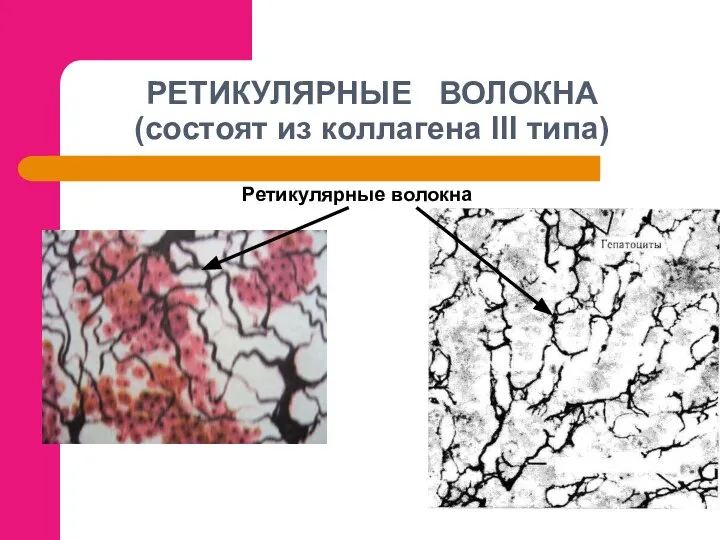 РЕТИКУЛЯРНЫЕ ВОЛОКНА (состоят из коллагена III типа) Ретикулярные волокна