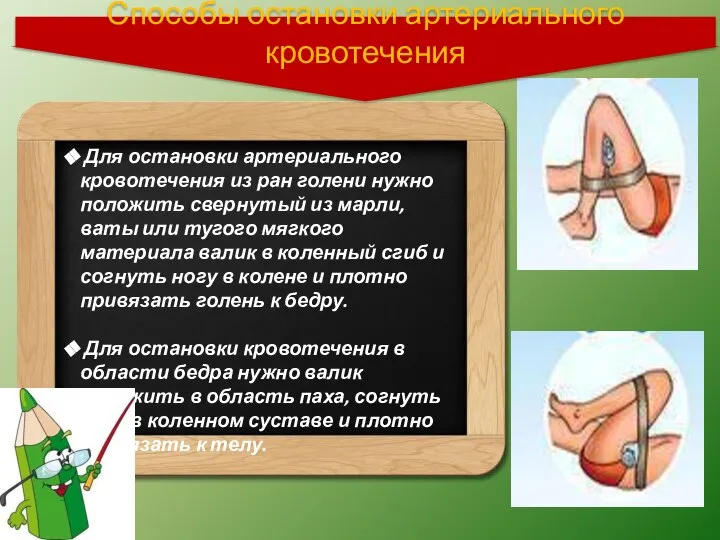 Для остановки артериального кровотечения из ран голени нужно положить свернутый из