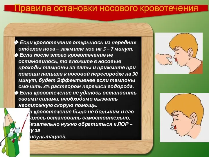 Правила остановки носового кровотечения Если кровотечение открылось из передних отделов носа