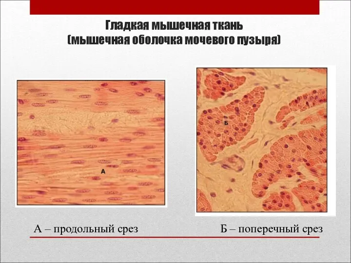 Гладкая мышечная ткань (мышечная оболочка мочевого пузыря) А – продольный срез Б – поперечный срез