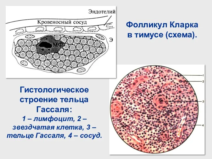 Фолликул Кларка в тимусе (схема). Гистологическое строение тельца Гассаля: 1 –