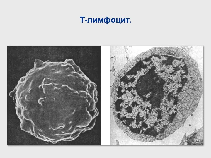 Т-лимфоцит.