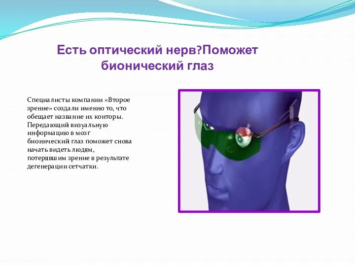 Есть оптический нерв?Поможет бионический глаз Специалисты компании «Второе зрение» создали именно