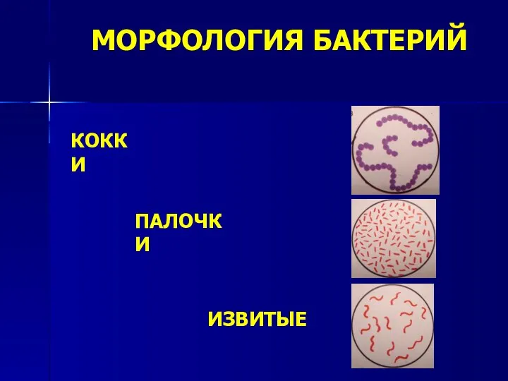 МОРФОЛОГИЯ БАКТЕРИЙ КОККИ ПАЛОЧКИ ИЗВИТЫЕ