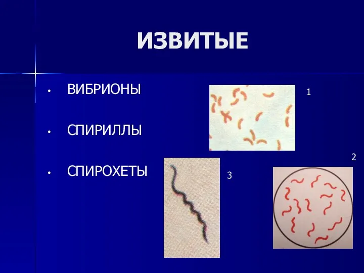 ИЗВИТЫЕ ВИБРИОНЫ СПИРИЛЛЫ СПИРОХЕТЫ 1 3 2