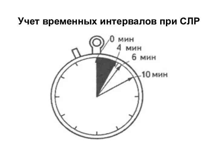 Учет временных интервалов при СЛР