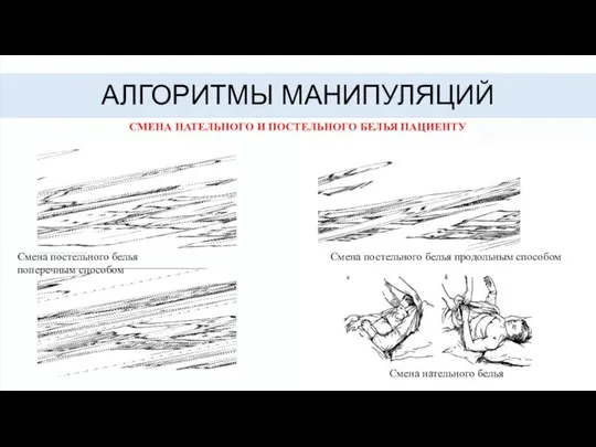 Алгоритмы манипуляций Смена нательного и постельного белья пациенту Смена постельного белья