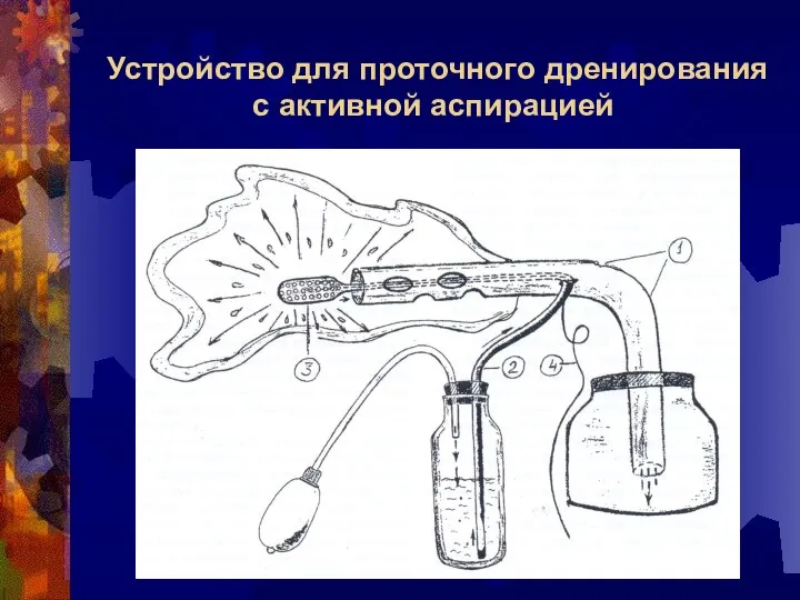 Устройство для проточного дренирования с активной аспирацией