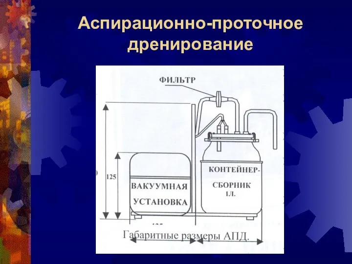 Аспирационно-проточное дренирование