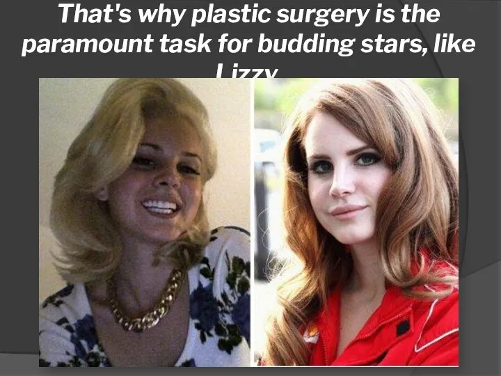 That's why plastic surgery is the paramount task for budding stars, like Lizzy.