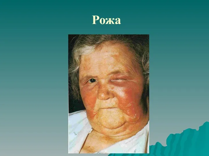 Рожа