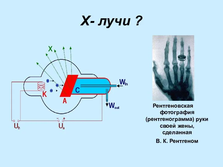 Х- лучи ? Рентгеновская фотография (рентгенограмма) руки своей жены, сделанная В. К. Рентгеном