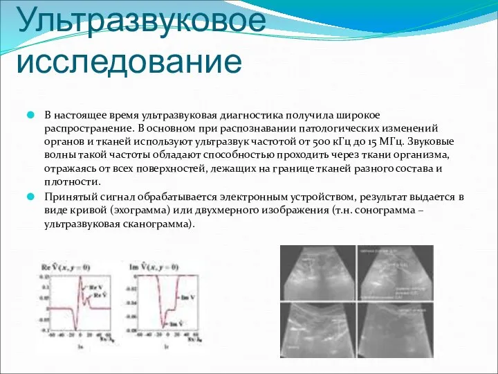 Ультразвуковое исследование В настоящее время ультразвуковая диагностика получила широкое распространение. В