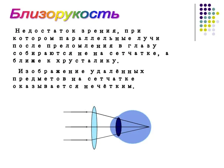 Близорукость Недостаток зрения, при котором параллельные лучи после преломления в глазу