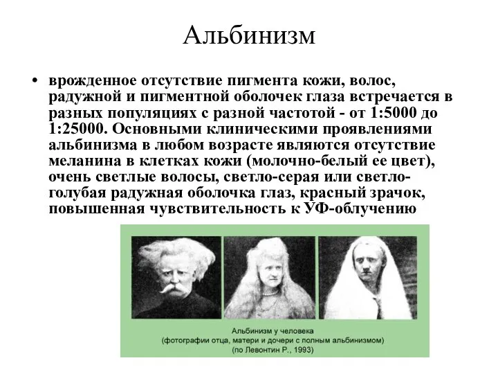 Альбинизм врожденное отсутствие пигмента кожи, волос, радужной и пигментной оболочек глаза