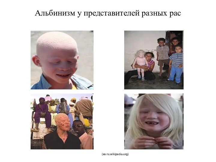 Альбинизм у представителей разных рас (из ru.wikipedia.org)